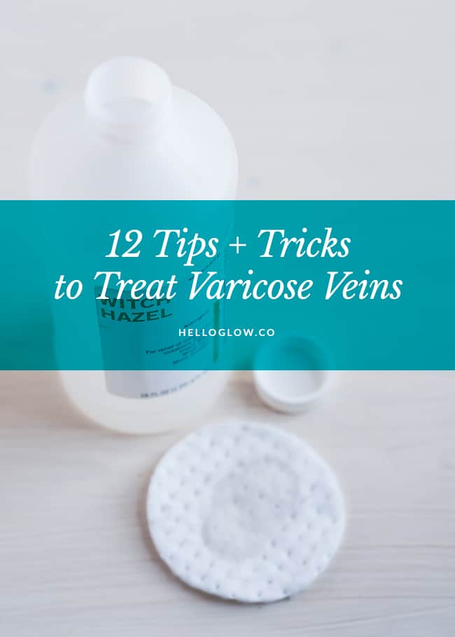 12 tips and tricks varicose veins